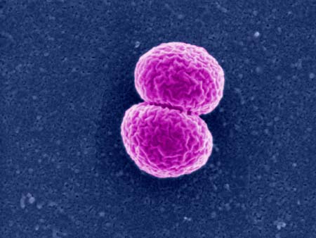 A scanning electron microscope picture of a Neisseria meningitidis bacterium